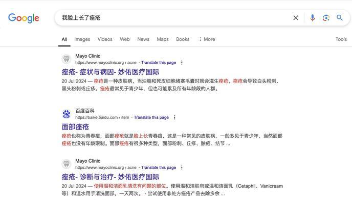 搜索引擎可以更换吗？如何更换搜索引擎？